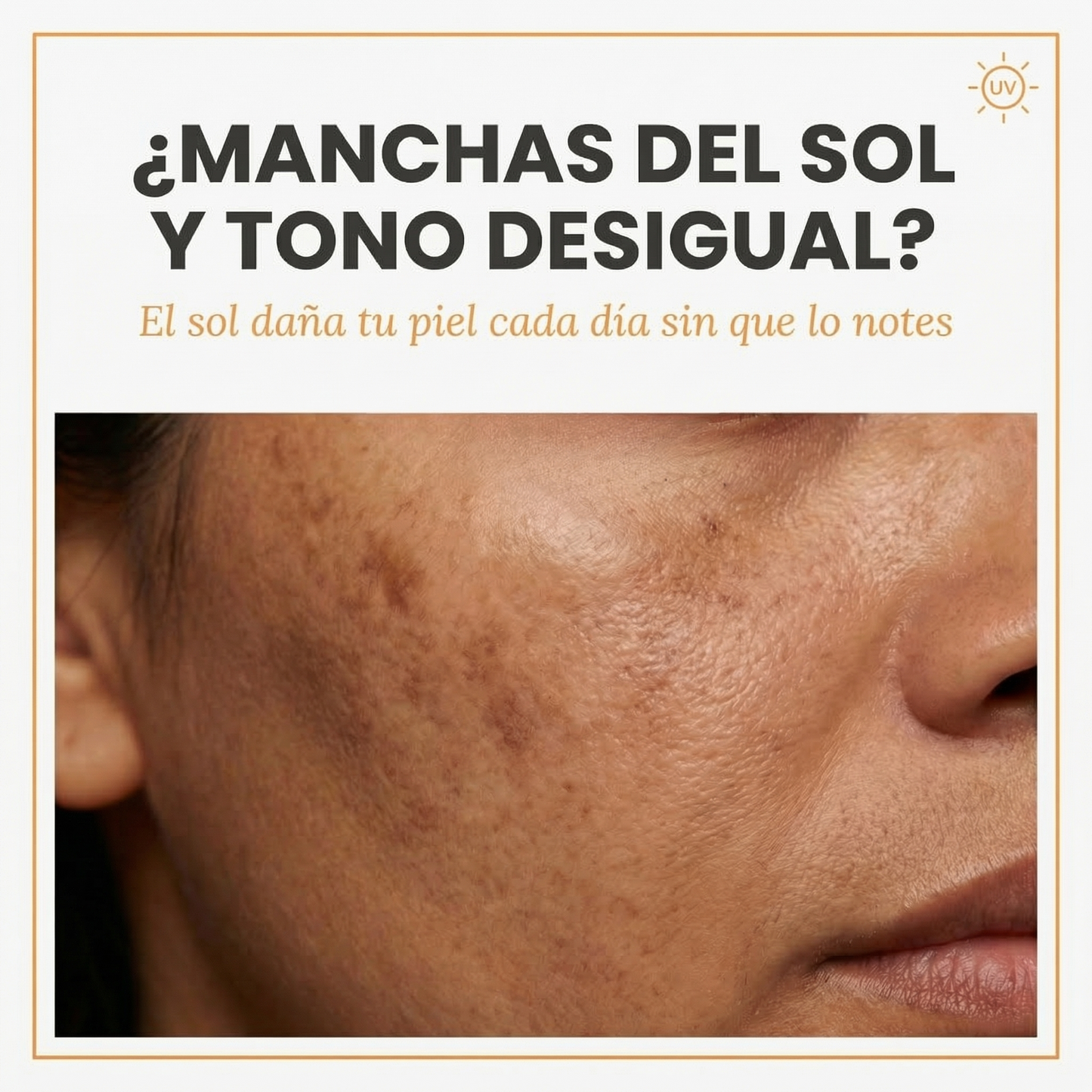 Lindonia® Bloqueador Glow Coreano SPF50