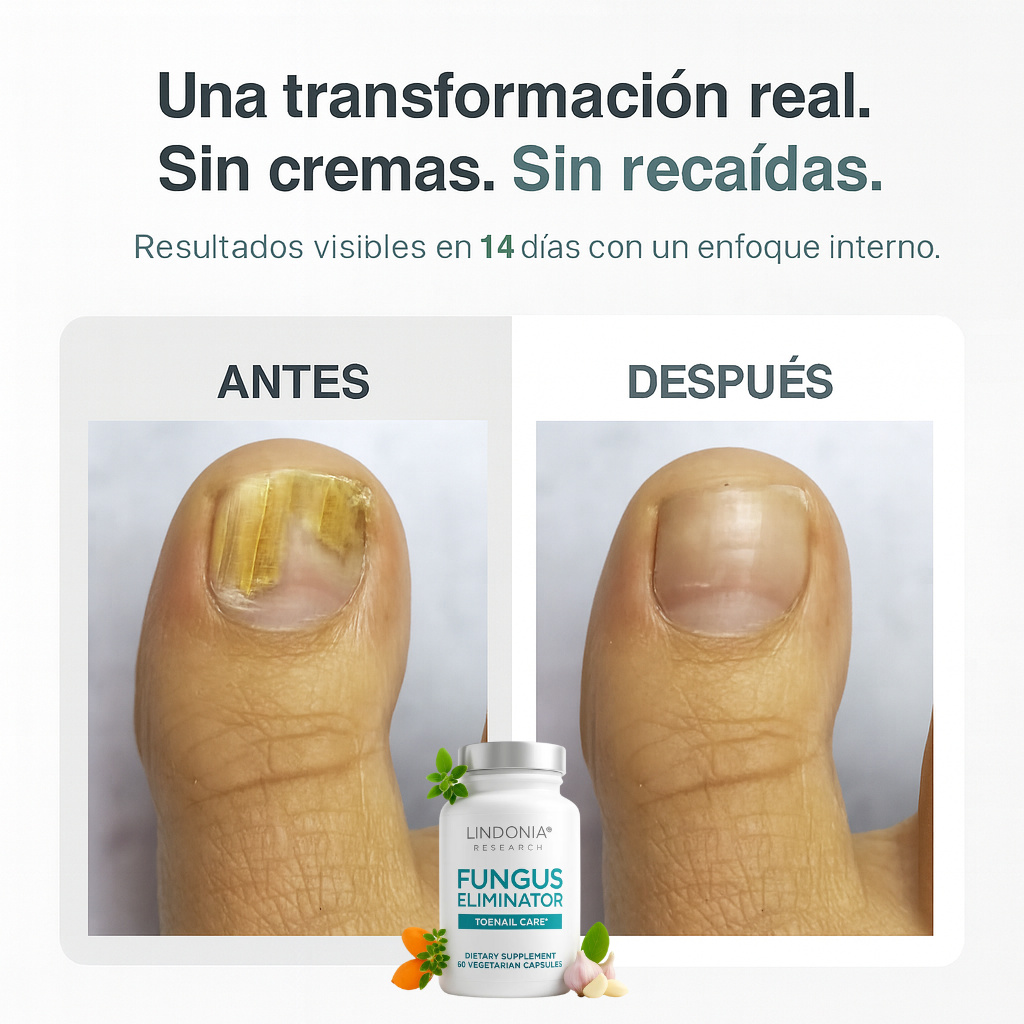 Lindonia® FungusEliminator - Cápsulas Anti-Hongos