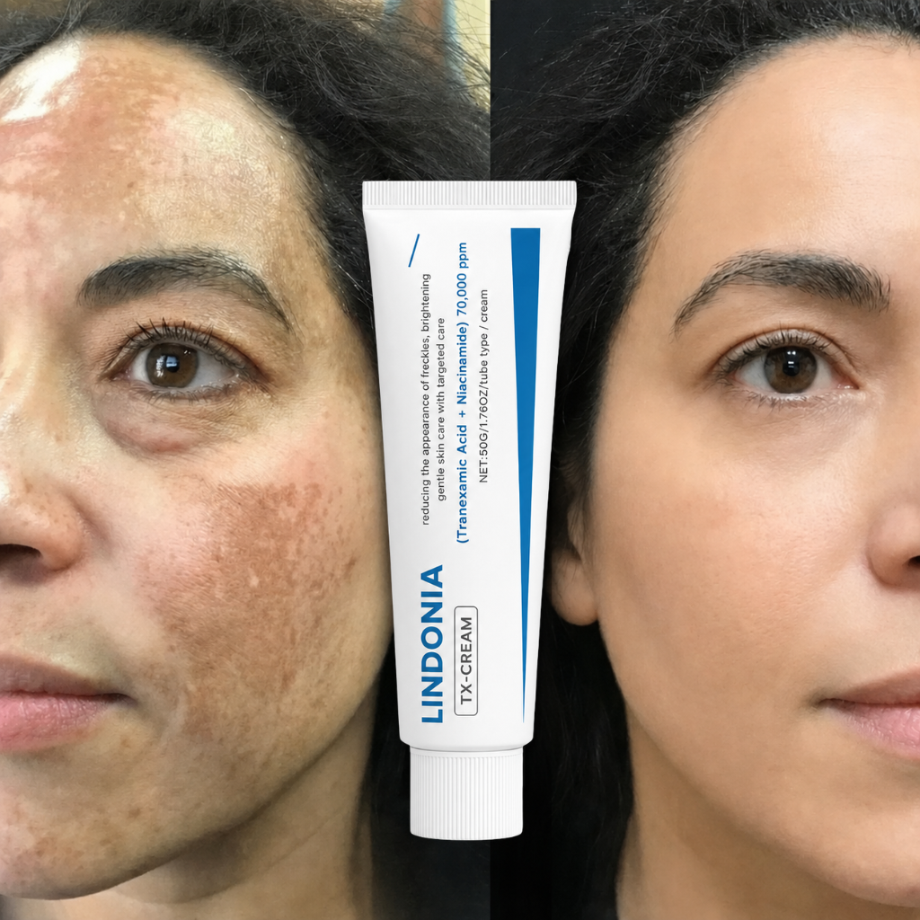 Lindonia® Corrector de Manchas